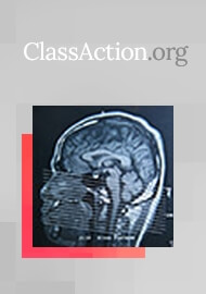 Concussion Injuries Have Americans Rethinking Professional Sports