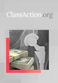 Lawsuits, Recall to Cost Stryker More than $1 Billion