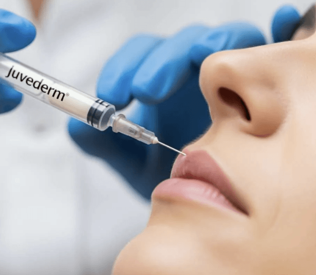 Juvederm Lawsuit Claims AbbVie Failed To Disclose Granuloma Risk Associated With Injections