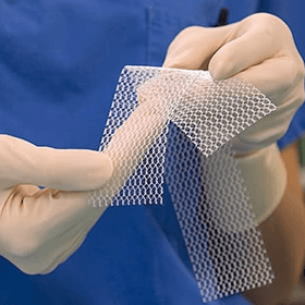 Medicare Advantage Organization Sues Makers of Defective Pelvic Mesh Over Settlement Fund Payment