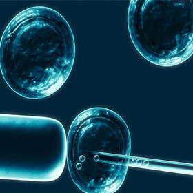 Woman Claims Giostar Misrepresented Efficacy of Stem Cell Treatment for Cancer, Other Diseases