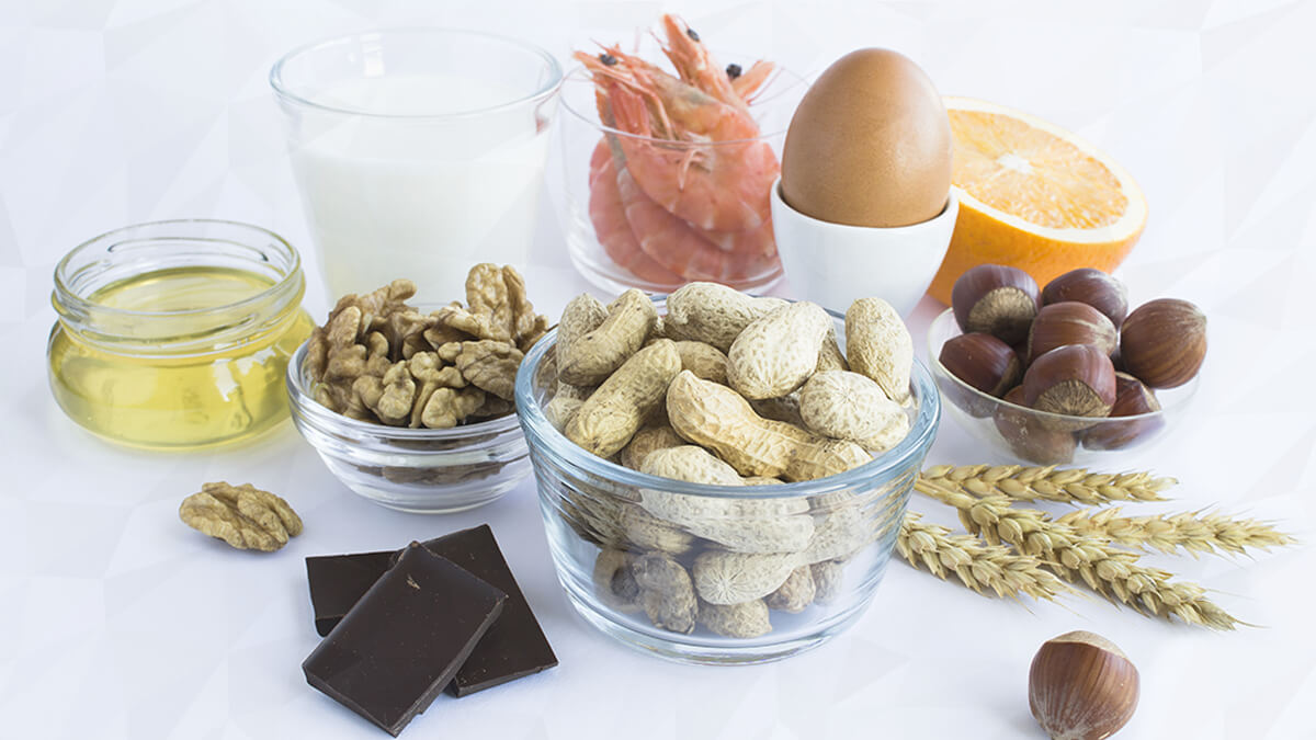 ‘Myths, Gimmicks, and Pseudoscience’ Everlywell Food Sensitivity Tests